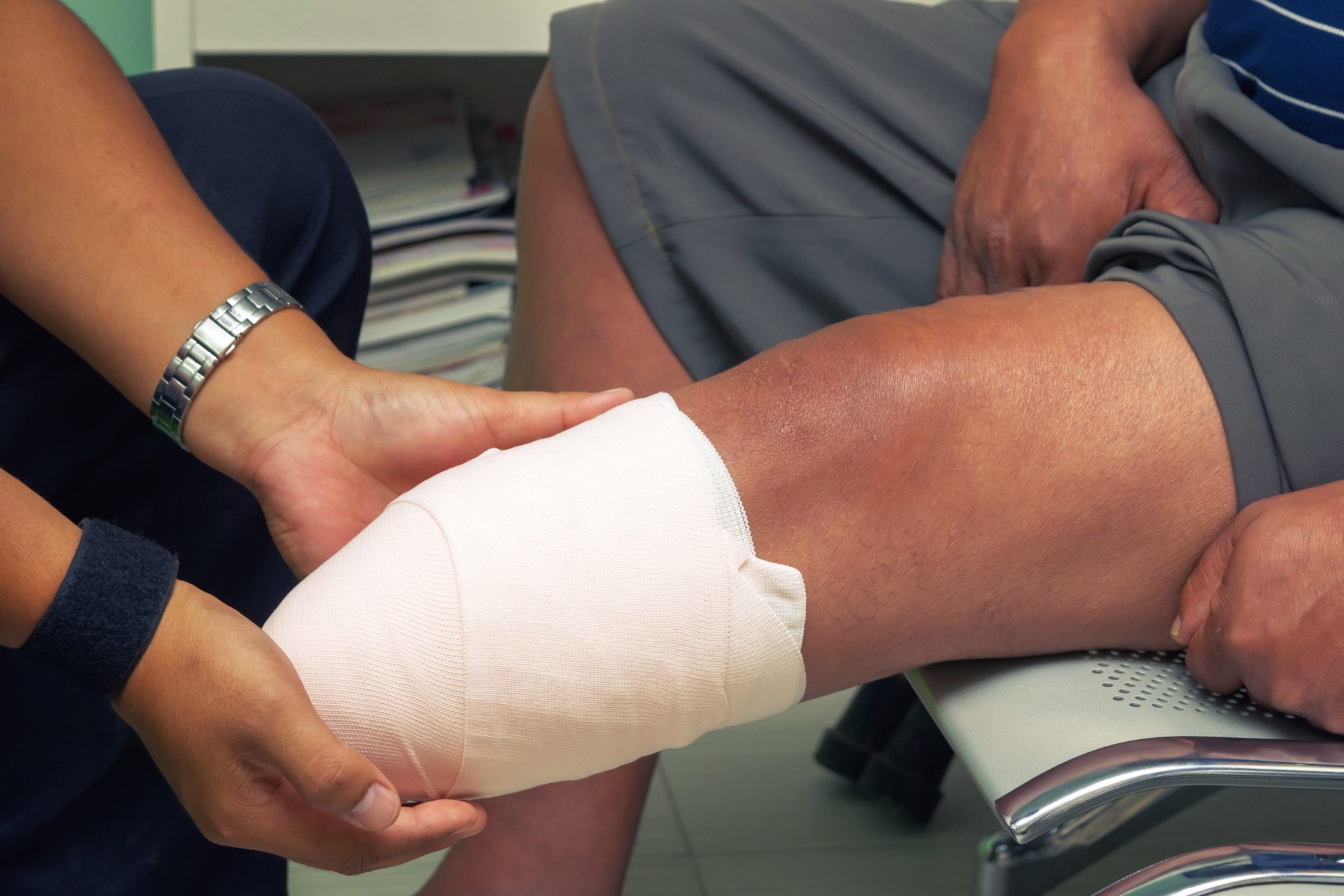 Texas Amputation Injury Attorney