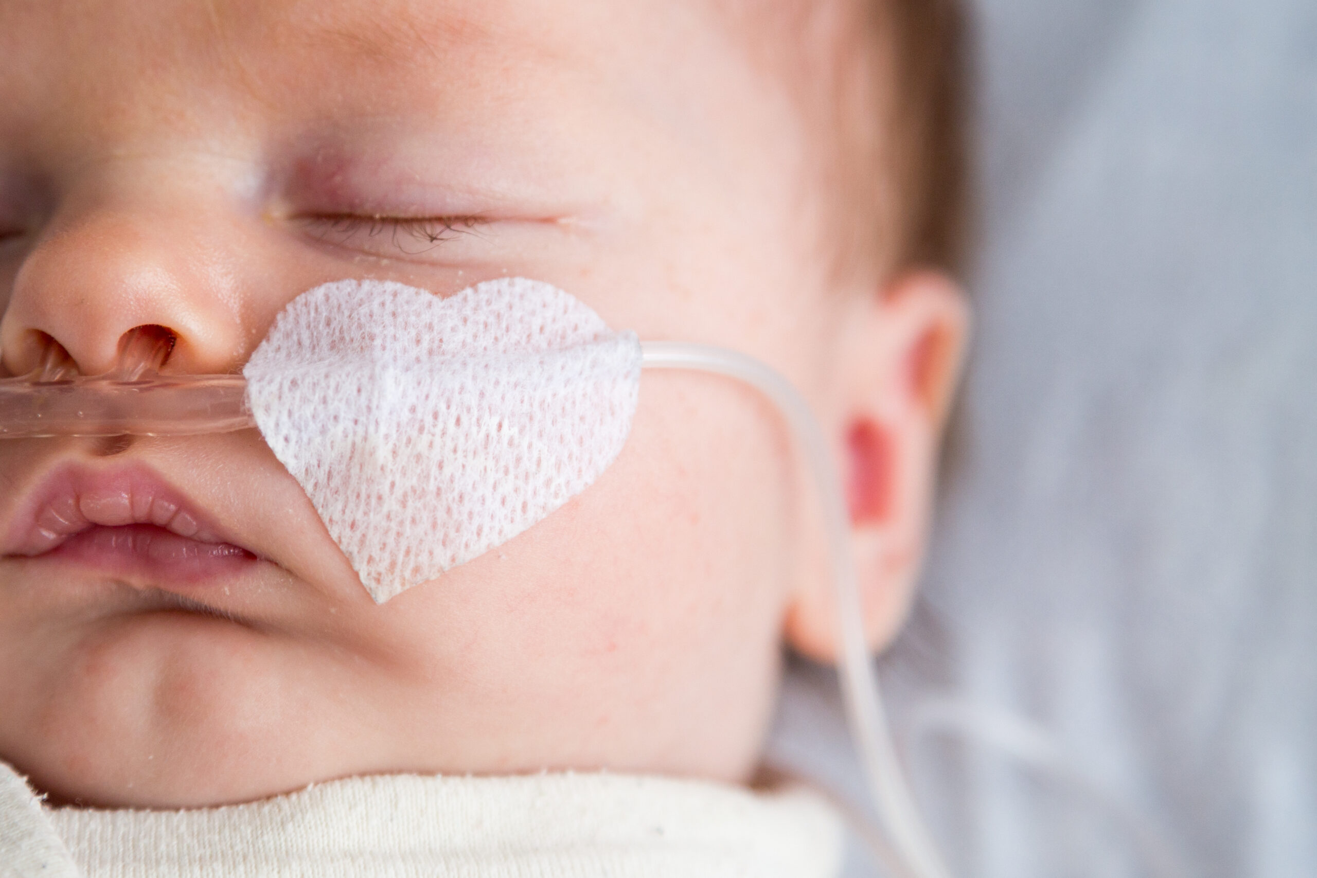 Texas Birth Injury Attorney